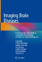 Imaging Brain Diseases  A Neuroradiology, Nuclear Medicine, Neurosurgery, Neuropathology and Molecular Biology-based Approach  [electronic resource]
